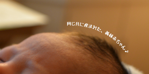 乳児脂漏性湿疹 赤ちゃんの湿疹状頭皮が大変でした 1 5か月でカサブタ取れたよ Kakkon Net