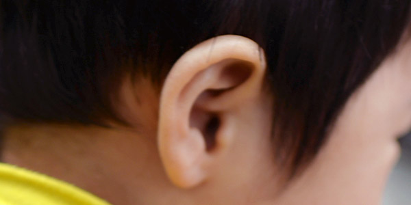耳垢シリーズ 耳鼻科で赤ちゃんの耳垢除去 1歳では遅かった 耳垢栓塞の予感 Kakkon Net